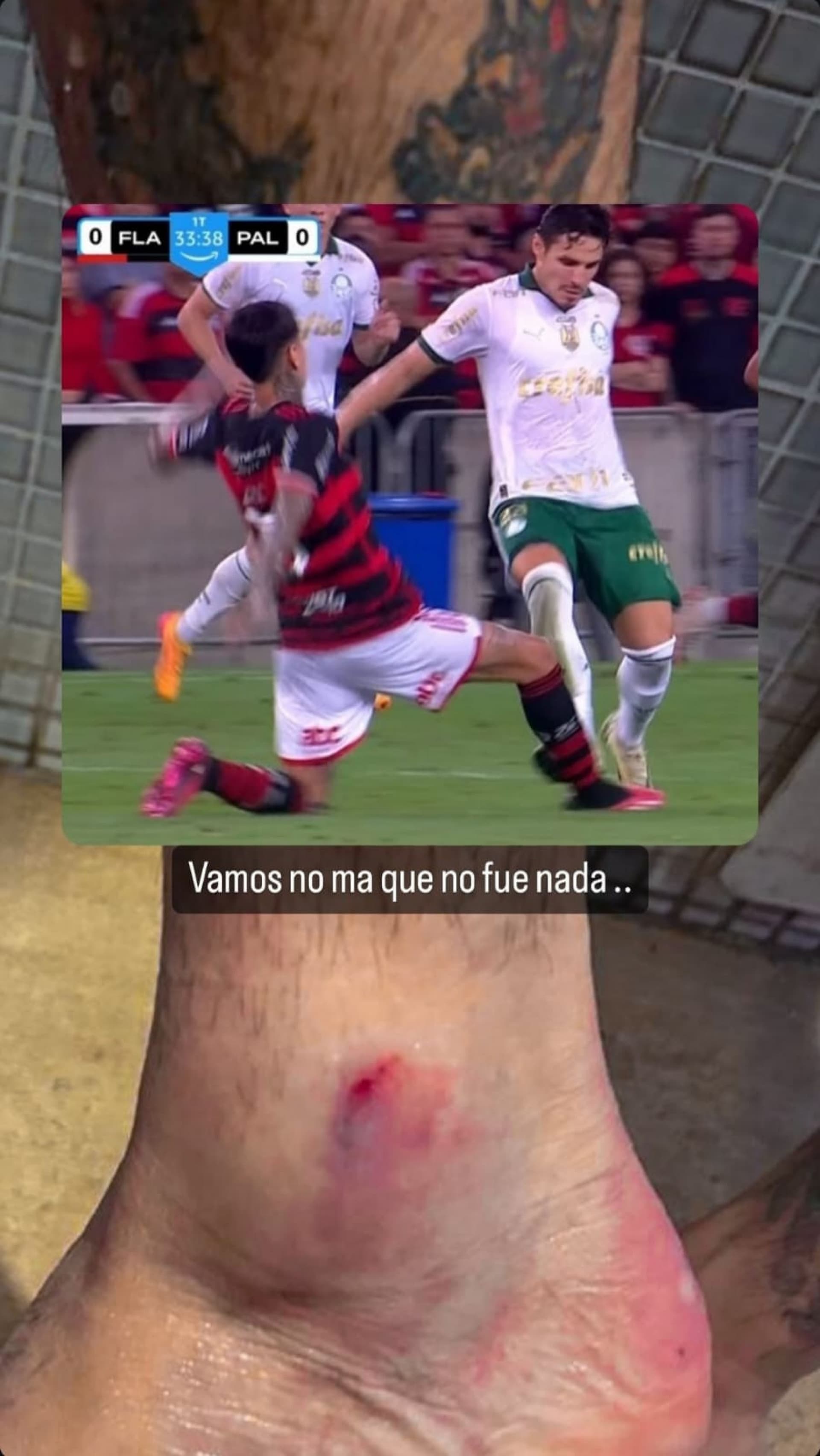 Pulgar, do Flamengo, posta foto do tornozelo machucado e ironiza VAR contra o Palmeiras